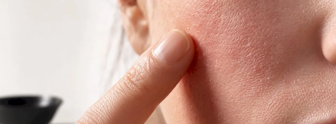 Ceramid‑Creme: Vorteile für Ihre Hautbarriere im Überblick