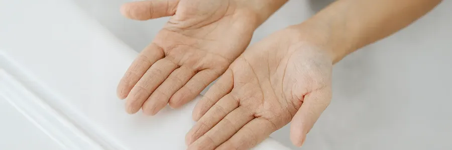 Trockene Haut? Kein Drama. So wird sie wieder geschmeidig.